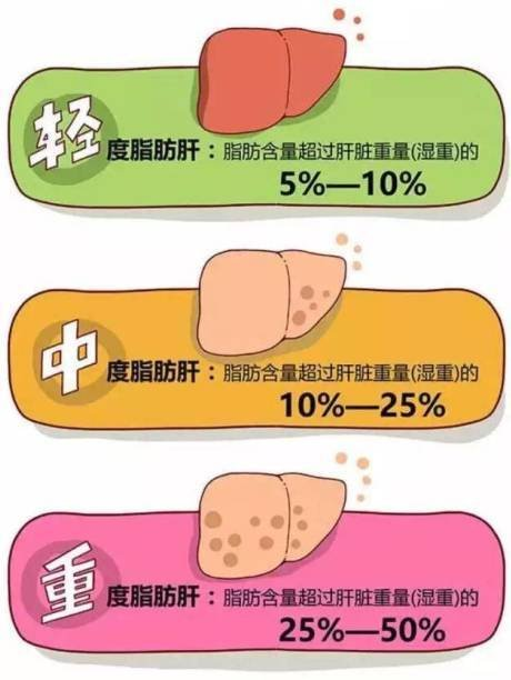 脂肪肝如何消除您知道嗎