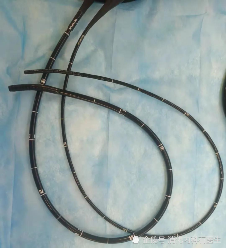 儿童胃痛可以做胃镜吗有危险吗