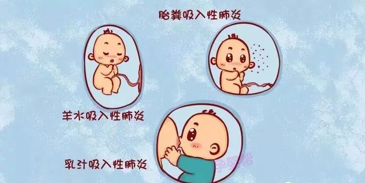 三个月婴儿肺炎早期症状有哪些 ( 三个月婴儿肺炎早期症状)