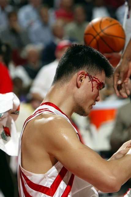 nba 盘点NBA那些血流满面的男人们