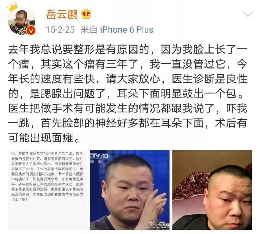 岳云鹏剃光头因身体问题停工与妻子先后做手术小女儿刚7岁