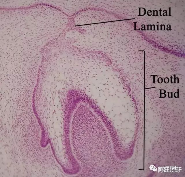 其实这个我们医学叫做上皮珠,是生长发育过程中的短暂现象,绝非病态