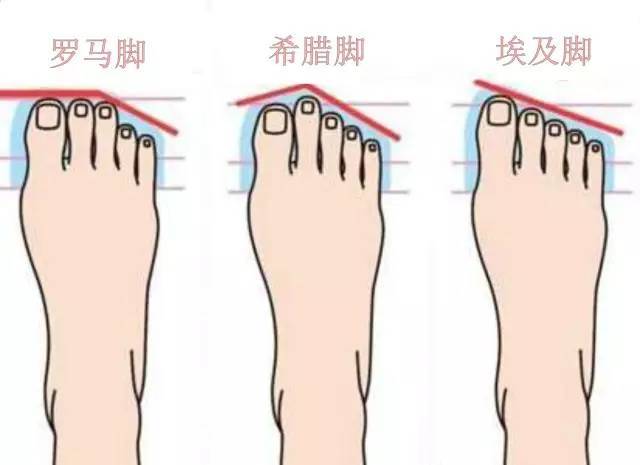 我们根据脚趾长度的差异,把脚型分为3种,分别为埃及脚,希腊脚和罗马脚