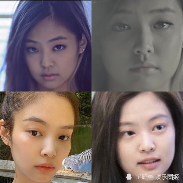 jennie blackpink 真整容了吗?