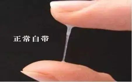 将问题扼杀在萌芽期~正常的白带是乳白色,半透明的,呈蛋清或者凝乳状
