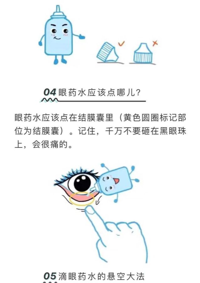 如何正确点用眼药水及注意事项