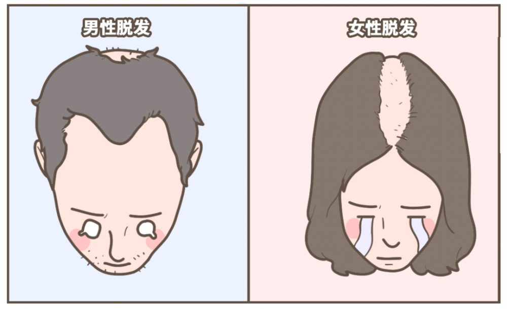 每天喷一喷发际线真的长出来了