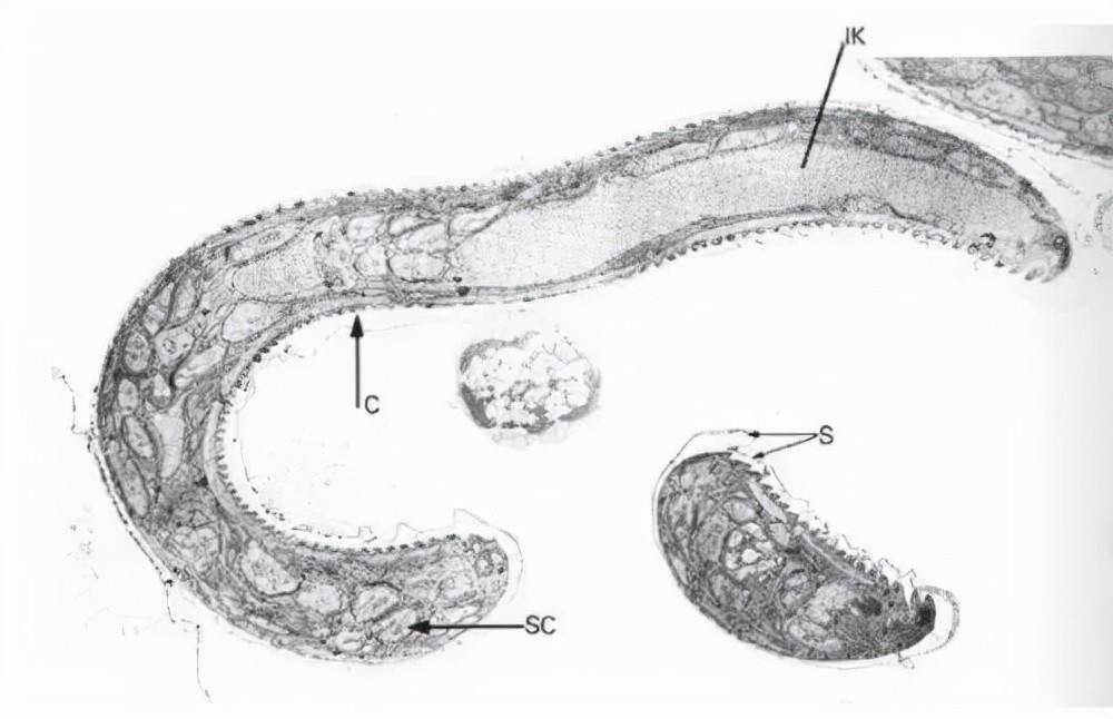 因为贪吃 男子脑子长虫了 这些 美食 里满是虫子 你还经常吃 腾讯新闻
