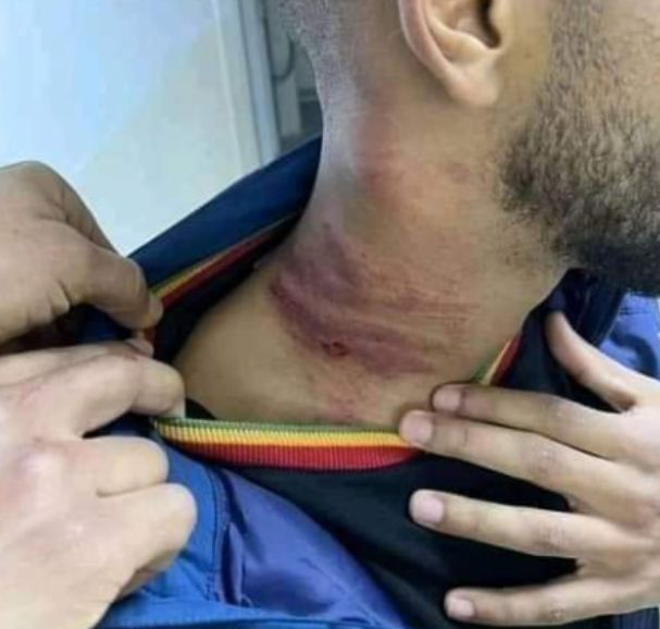 暴力足球再现门将飞踹前锋头部脖子上全是伤还留下大血洞