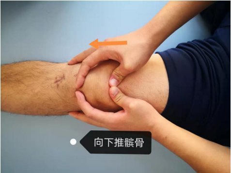 康复治疗师手把手教你有效"推髌骨"