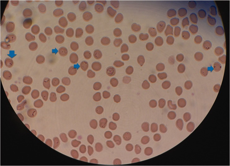 附红细胞体对四环素类和氨基糖苷类