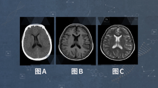 積水潭醫院代診掛號核磁(MRI)到底有什么區別?的簡單介紹