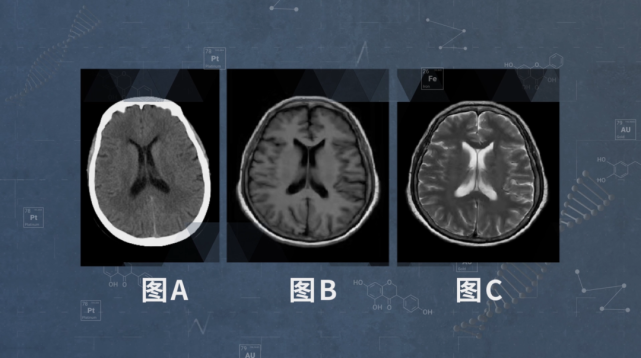 积水潭医院代诊挂号核磁(MRI)到底有什么区别?的简单介绍