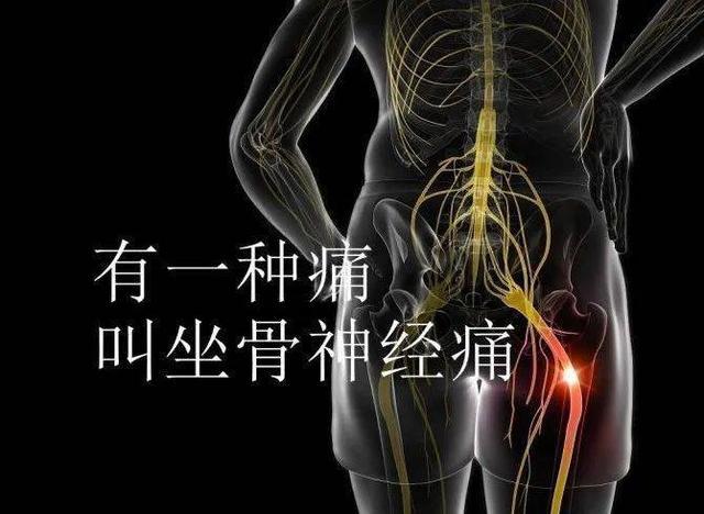 坐骨神经痛除给患者带来非常大的痛感还有哪些较为明显的症状呢