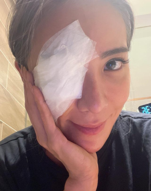 星二代右眼受伤缠上纱布却被质疑割双眼皮回击谁只割一边