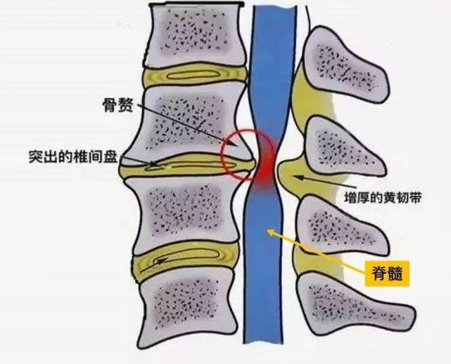 第七颈椎图片图片