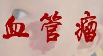 这些红色的"印记"很可能就是孰不知认为是胎记很多父母都不会在意红色