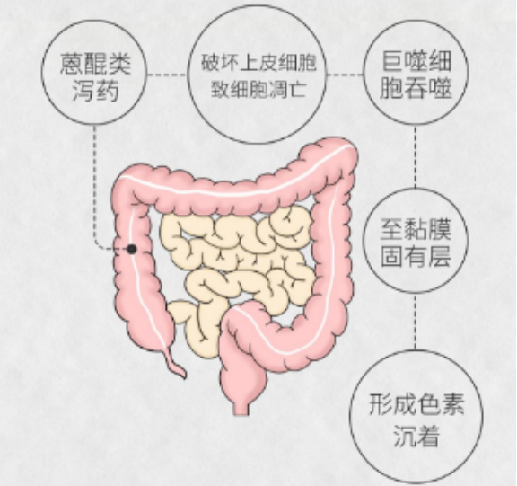 熊理守教授:慢性便秘如何进行长期治疗?