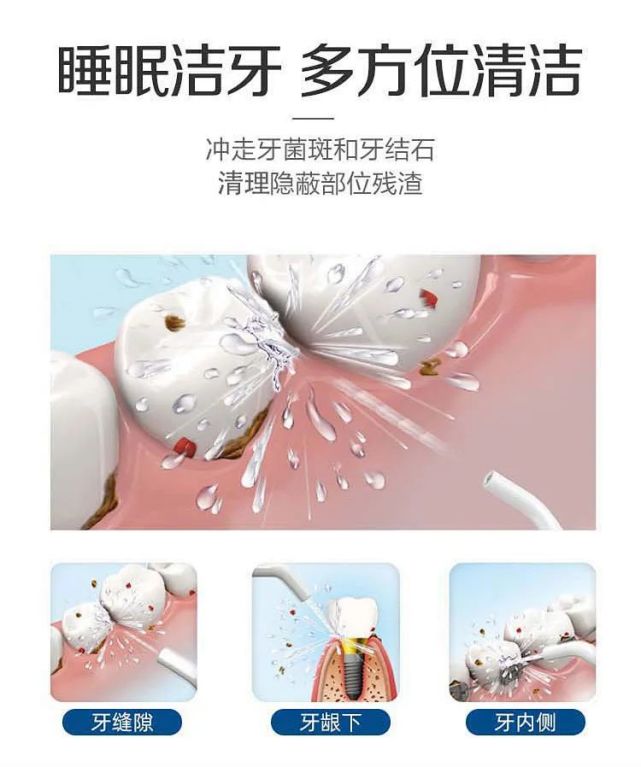 河源这家牙科竟然有火爆全球的spa睡眠洁牙!试业期间大放福利