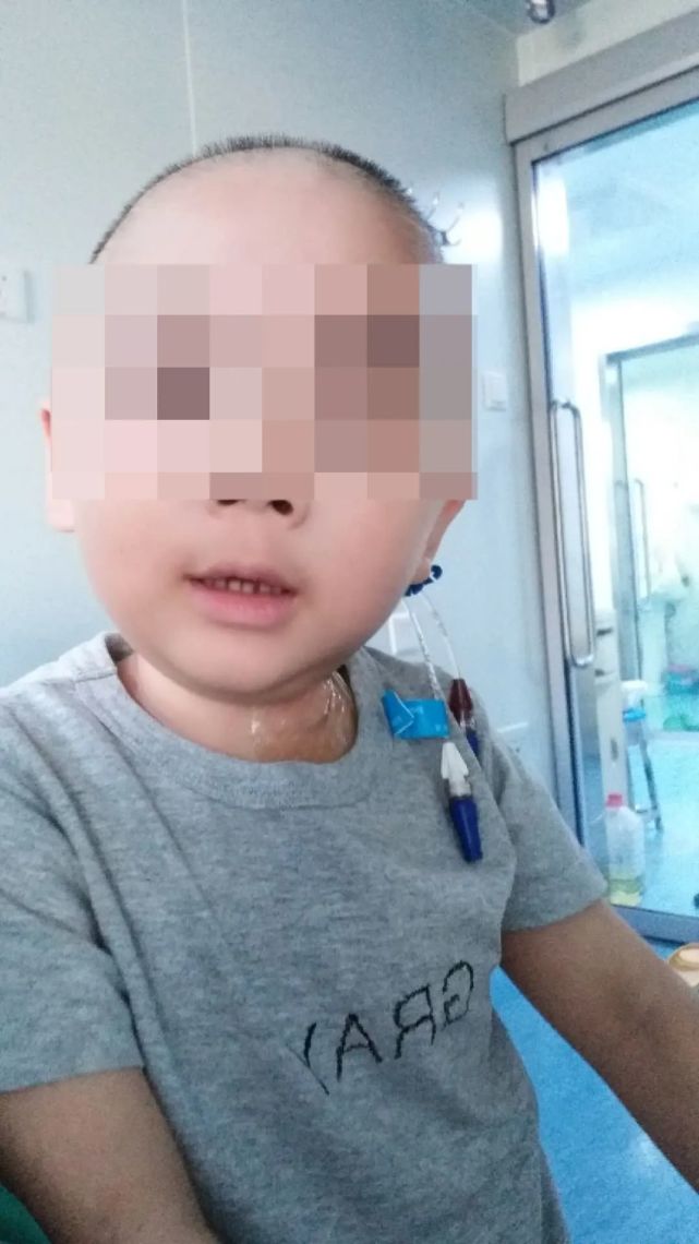 我们再次来到首儿所,这次决定做移植,别的小朋友做了移植都恢复的不错