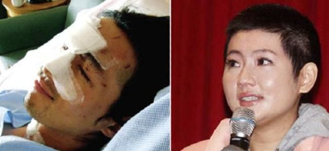 俞灏明与任家萱重度烧伤火吻任家萱作为中国女子天团she的成员之一,靠