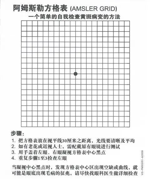 眼底黄斑病变还有救50岁以上必须要注意