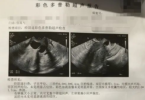 b超檢查顯示子宮內膜厚1.2cm回聲不均,宮頸多發納氏囊腫.