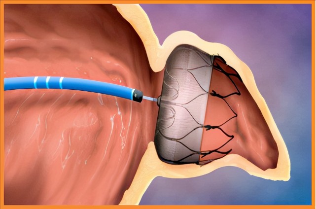 心脏"房颤"对脑子有影响?心内科医生告诉你真相_腾讯新闻