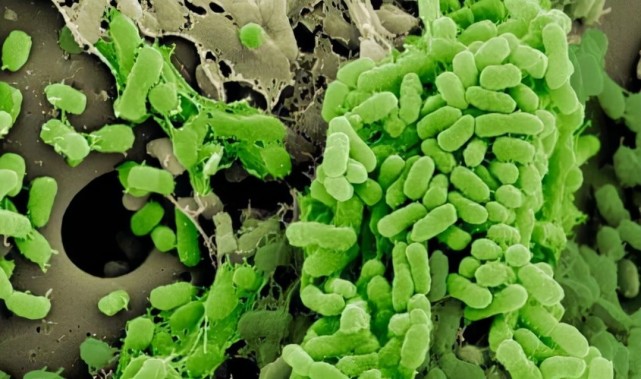 这一点相当于踢足球时候的助攻,有些细菌比如呼吸系统常见的铜绿假单