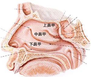 鼻甲肥大是因为鼻粘膜在炎症(鼻炎,鼻窦炎等)刺激下形成的鼻甲粘膜