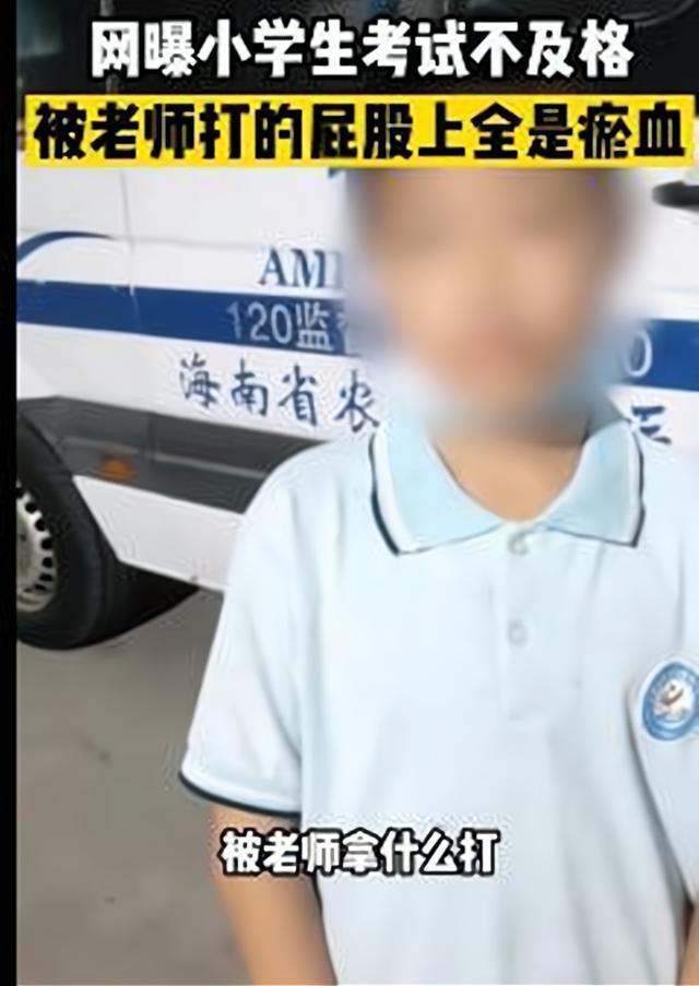 海南六年級小學生考試不及格被數學老師打,教育局:老師停職!