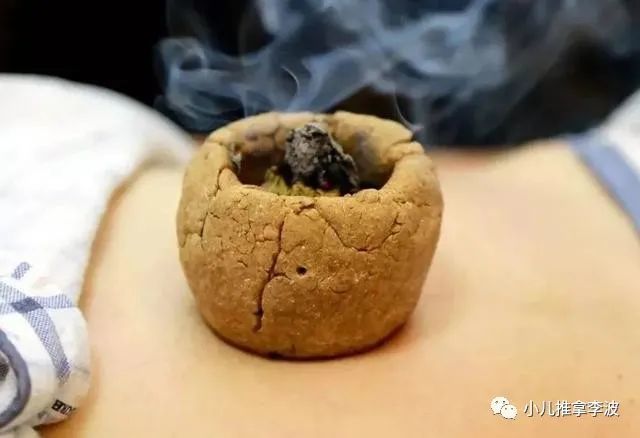 世界艾乡资讯-中医儿科李波:脐灸疗法作用机制,功效优点,操作注意事项