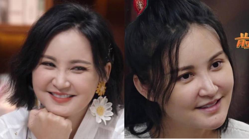 凹凸不平眼睛挤成一条缝发面馒头脸毁了多少高颜值明星