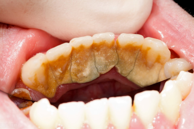 为什么我们的牙齿是黄黄的还能抠出黄泥并且很臭不妨学习这3招