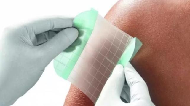 水胶体敷料泡沫敷料当然,在不同的愈合阶段,需要不同的敷料和护理方法