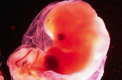 4个月流产胎儿图片图片
