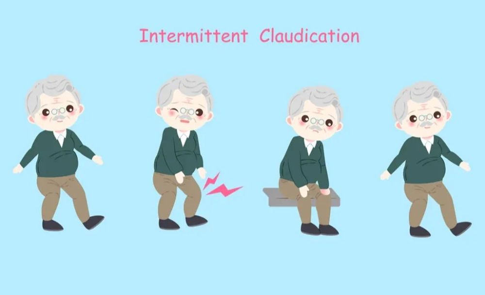 什么是间歇性跛行?应该挂什么科?