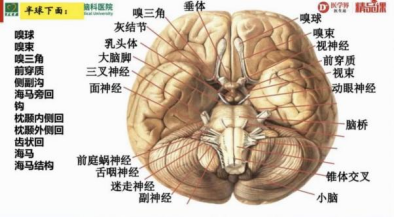 簡明又詳細的頭部ct讀片詳解!