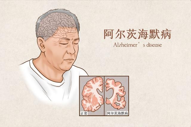 阿尔茨海默症老人走失7h后的哥送回家有痴呆老人须注意这些事