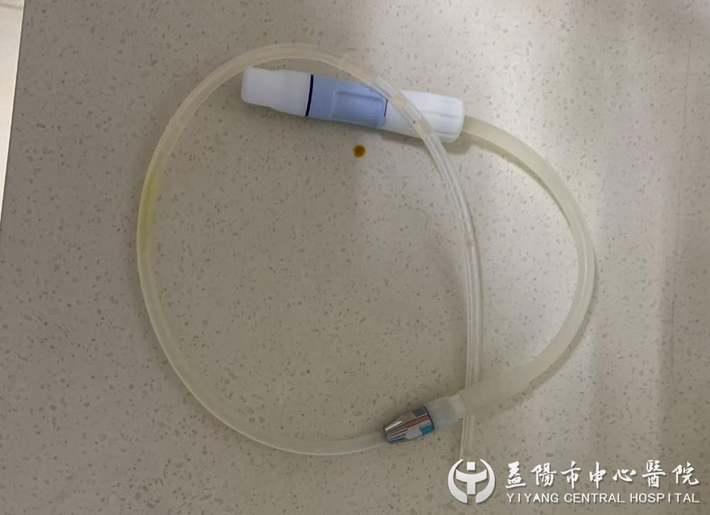 这家医院肾内科开展"pull"新式腹膜透析拔管术_腾讯新闻