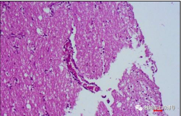 在组织病理学检查中,内基氏小体(negri bodies)通常出现在狗的海马中