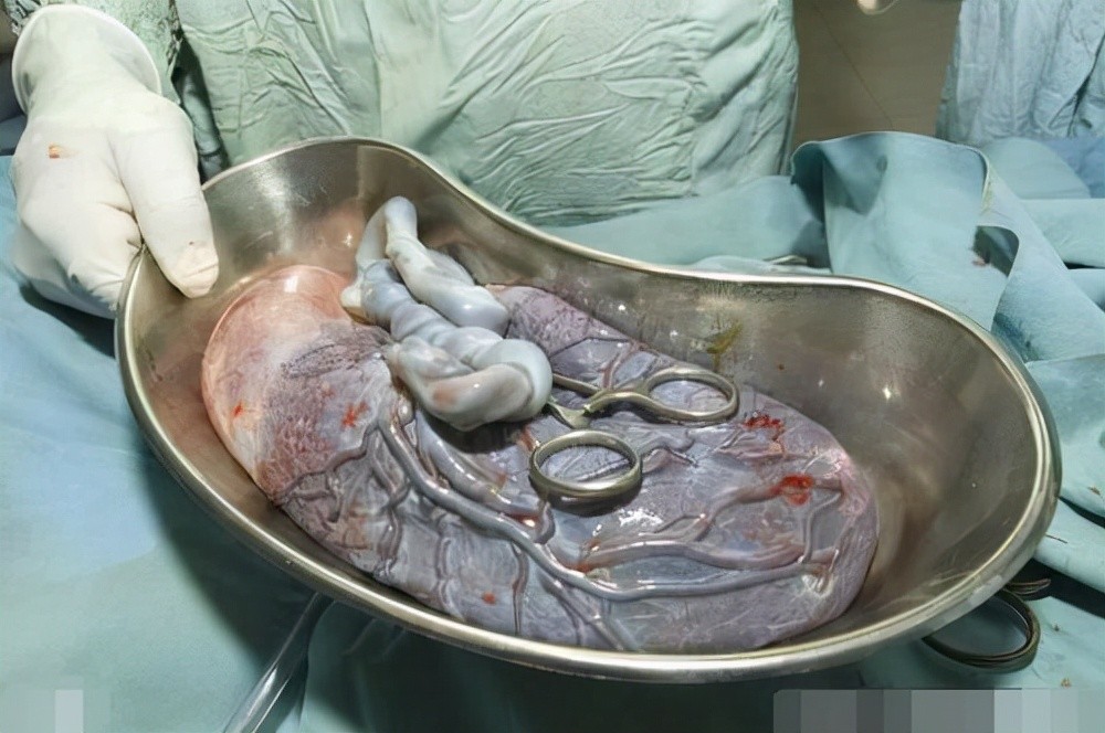 胎盘到底该不该吃?"神药"还是"伪科学"?_腾讯新闻