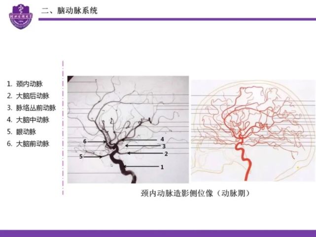 腦血管的應用解剖詳解