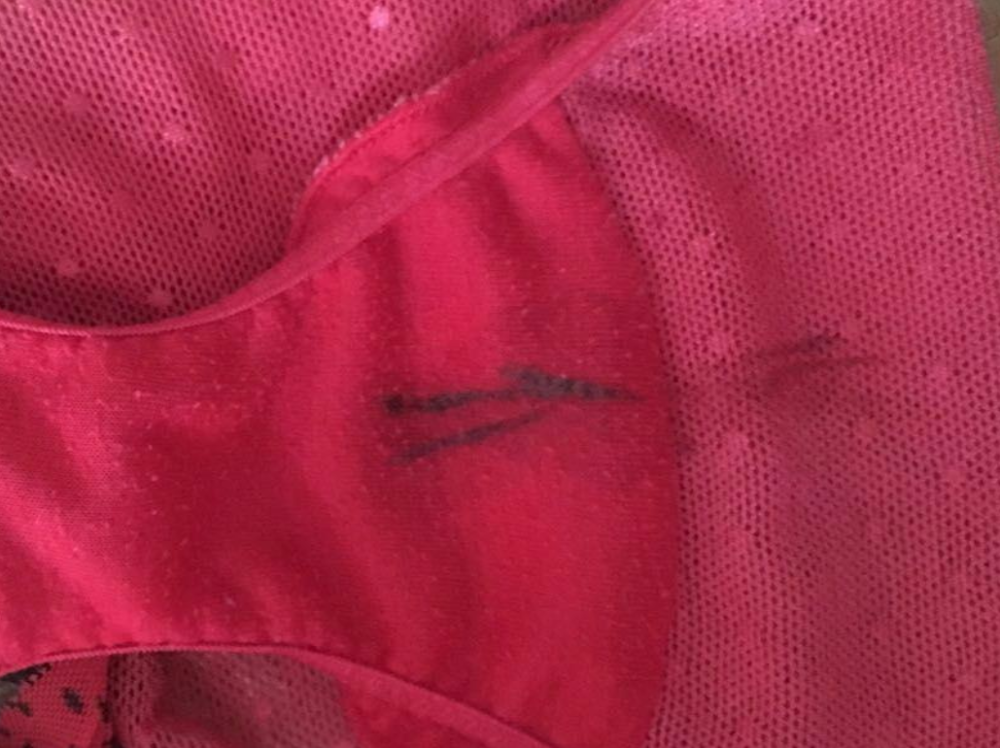 hpv导致宫颈病灶出现后,白带分泌量会增多,颜色受病灶破裂出血影响,也