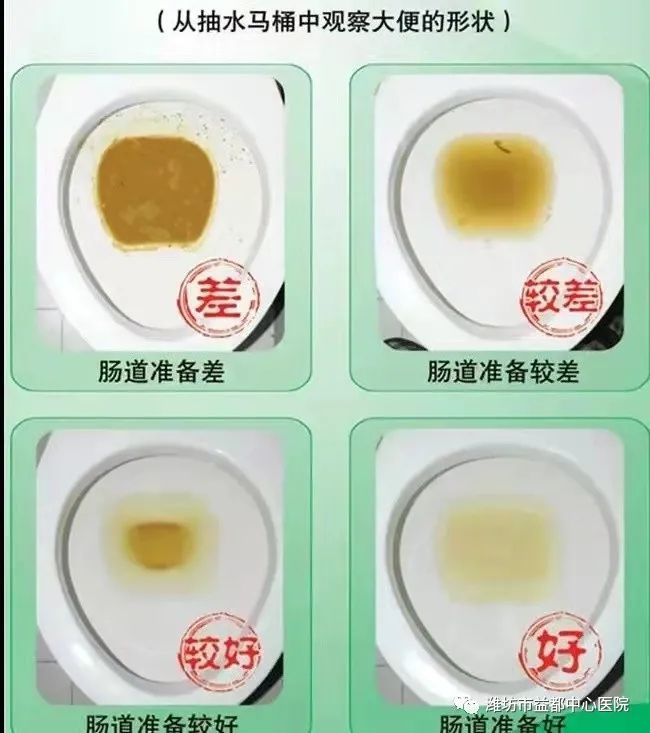 免费结直肠癌筛查开始啦适合青州这些人