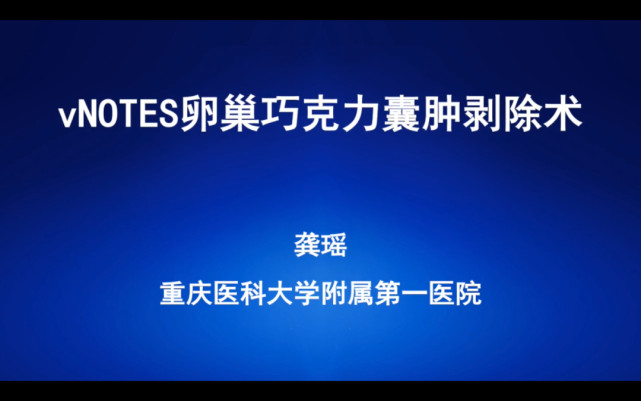 vnotes 手術視頻系列:卵巢巧克力囊腫剝除術