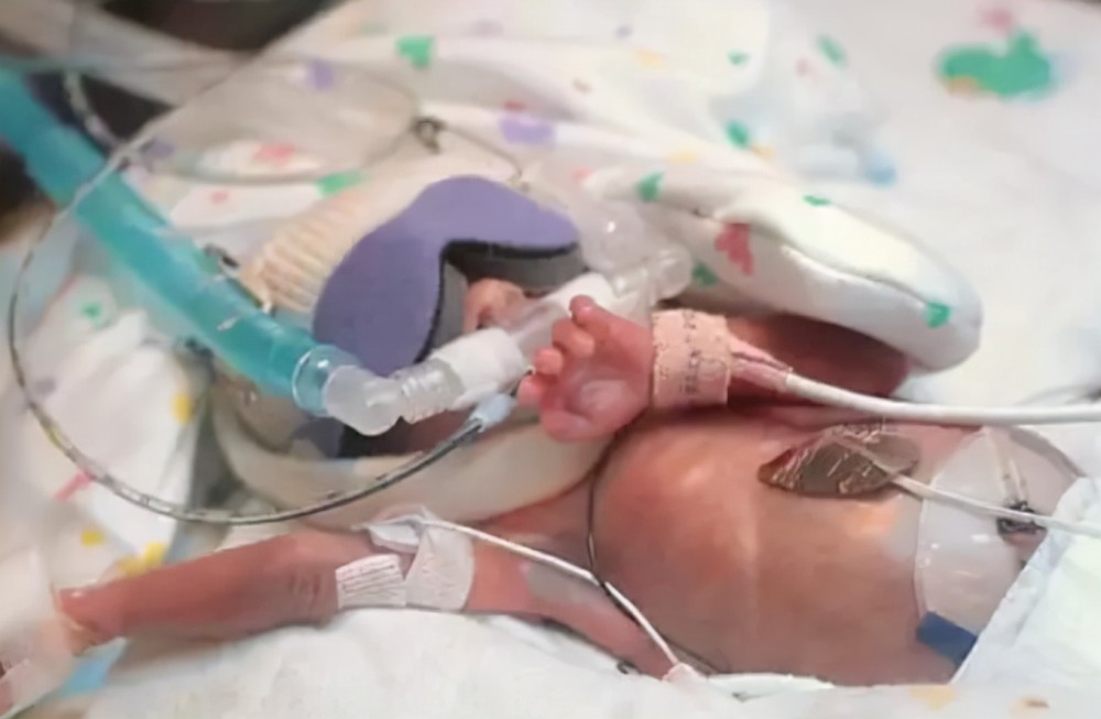 早产宝宝住保温箱很可怜看过他在里面的经历就不揪心了