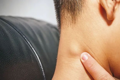 淋巴结肿大疼比不疼好这些部位摸一摸可自查