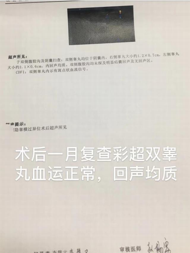 孩子只有一个蛋蛋医生极少见的睾丸横过异位