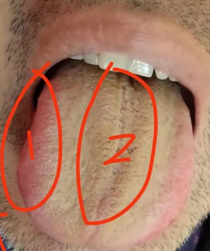 舌象分析短气胆小